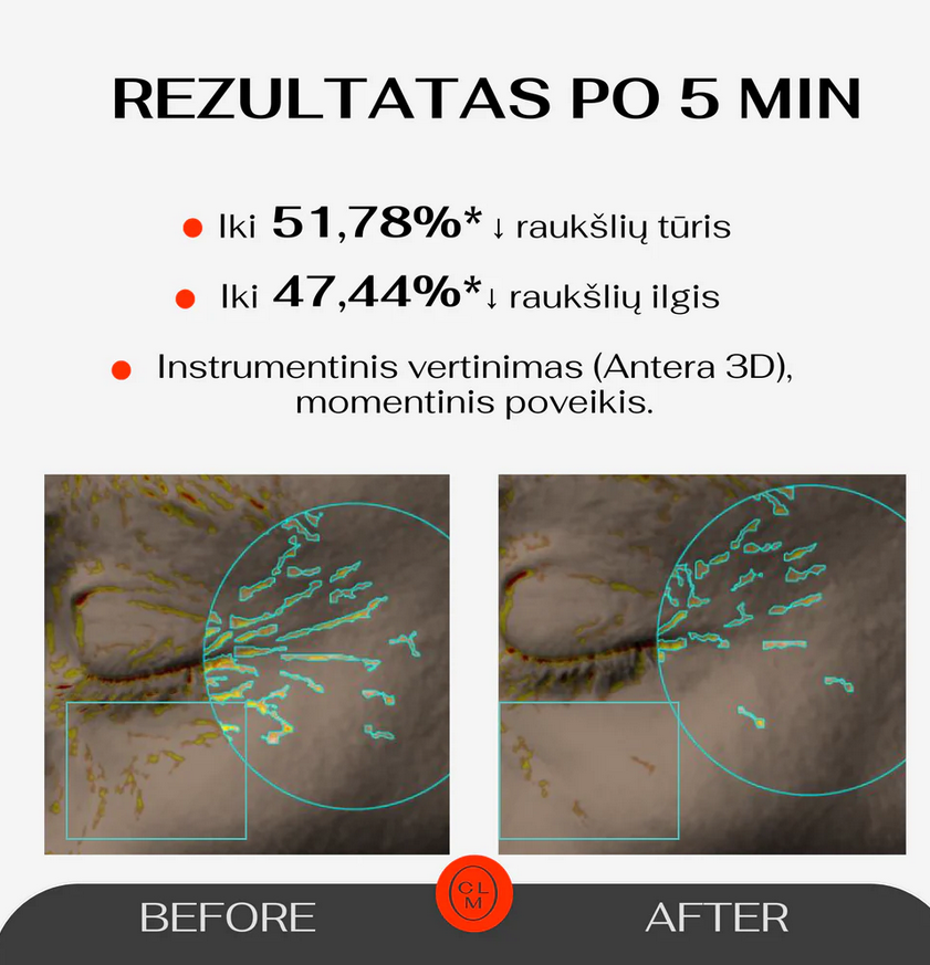 CLM Paakių padeliai 5 Minute Revolution 3ml (5 vnt)